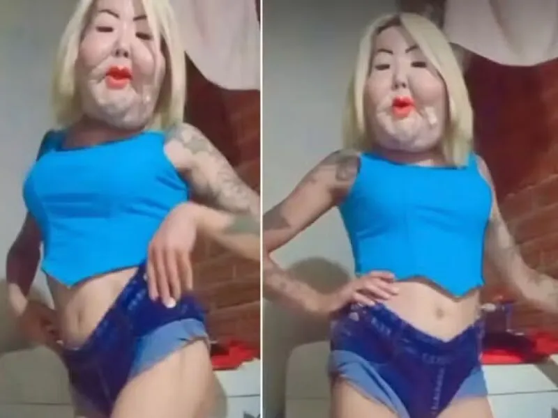 Juju do Pix: entenda a cirurgia realizada pela influenciadora