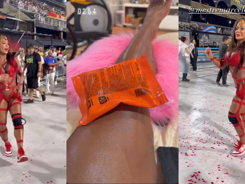 Lágrimas, fisioterapia e dor: entenda drama de Gracyanne Barbosa para voltar a sambar neste carnaval
