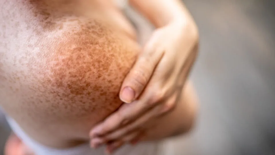 Como o corpo humano regenera novas clulas todos os dias