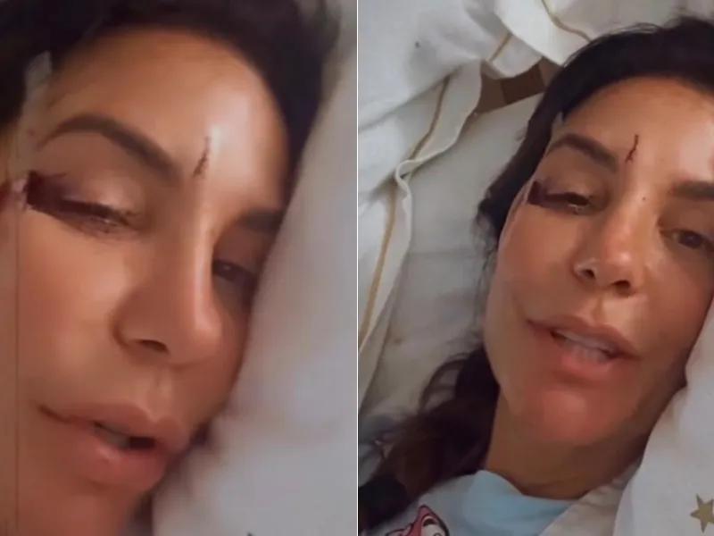 Fãs desejam melhoras a Ivete Sangalo após cantora desmaiar, sofrer cortes e ser internada