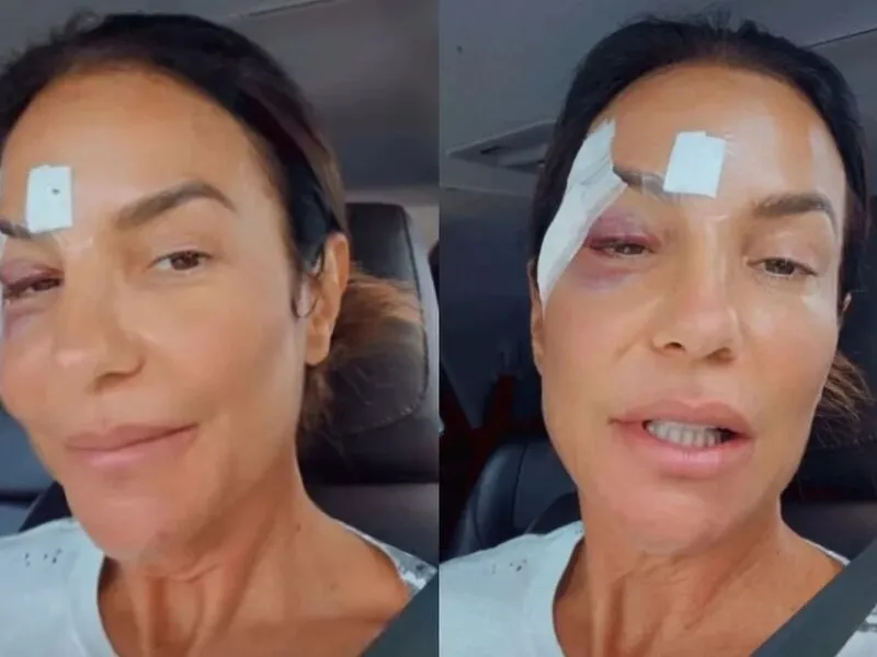 Ivete Sangalo recebe alta hospitalar e revela diagnóstico de síndrome vasovagal