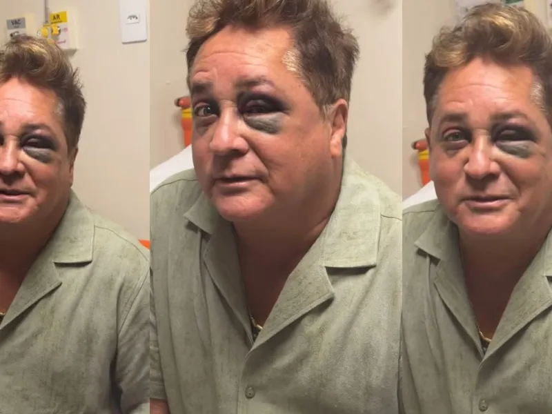 Leonardo sofre queda no Pantanal, faz exames, mas mantém agenda de shows