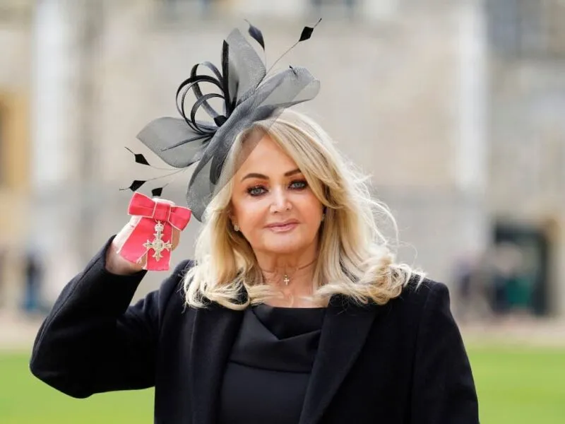 Equipe de Bonnie Tyler pede privacidade após cantora ser colocada em coma induzido