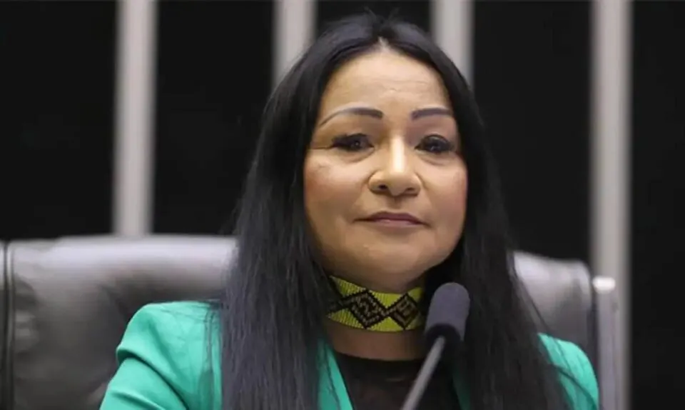 TSE mantém cassação de deputada do PL por uso de verba pública em harmonização facial