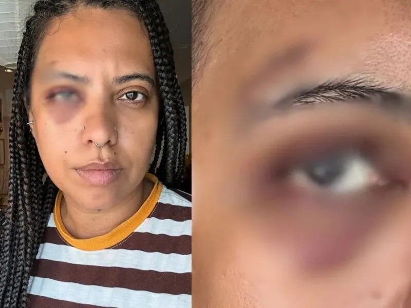 Influenciadora leva seis pontos após agressão em roda de samba no Rio